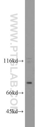 FSHR Antibody in Western Blot (WB)