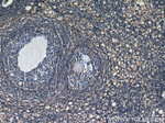 RBP1 Antibody in Immunohistochemistry (Paraffin) (IHC (P))