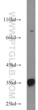 CCS Antibody in Western Blot (WB)