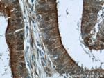 B3GNT7 Antibody in Immunohistochemistry (Paraffin) (IHC (P))