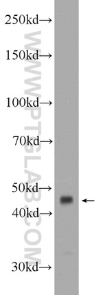 B3GNT7 Antibody in Western Blot (WB)