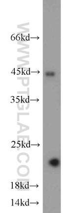 ACOT6 Antibody in Western Blot (WB)
