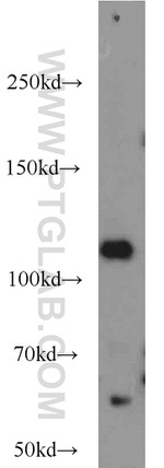 PARP1 Antibody in Western Blot (WB)