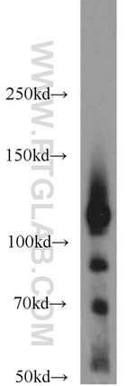 PARP1 Antibody in Western Blot (WB)