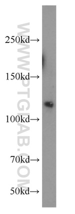 PARP1 Antibody in Western Blot (WB)