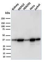 Aldo-keto Reductase Family 1 Member B1 Antibody in Western Blot (WB)
