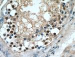 STAG3 Antibody in Immunohistochemistry (Paraffin) (IHC (P))