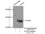 STAG3 Antibody in Immunoprecipitation (IP)