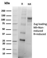 SATB2 (Colorectal Carcinoma Marker) Antibody in Immunoelectrophoresis (IE)