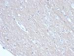 SATB2 (Colorectal Carcinoma Marker) Antibody in Immunohistochemistry (Paraffin) (IHC (P))