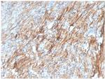 Fibronectin Antibody in Immunohistochemistry (Paraffin) (IHC (P))