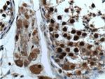 ZCCHC8 Antibody in Immunohistochemistry (Paraffin) (IHC (P))