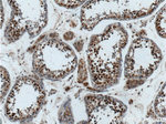 ZCCHC8 Antibody in Immunohistochemistry (Paraffin) (IHC (P))