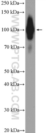 ZCCHC8 Antibody in Western Blot (WB)