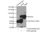 IL-6R Antibody in Immunoprecipitation (IP)