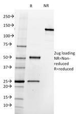 FOLH1/PSMA (Prostate Epithelial Marker) Antibody in SDS-PAGE (SDS-PAGE)
