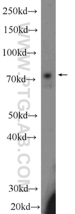 Ubiquilin 1 Antibody in Western Blot (WB)