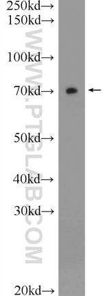 Ubiquilin 1 Antibody in Western Blot (WB)