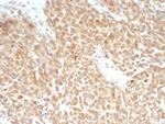 SLC7A11/xCT Antibody in Immunohistochemistry (Paraffin) (IHC (P))