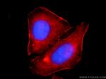 alpha Actin Antibody in Immunocytochemistry (ICC/IF)