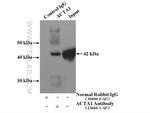 alpha Actin Antibody in Immunoprecipitation (IP)