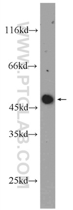 ARCN1 Antibody in Western Blot (WB)