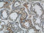 ARCN1 Antibody in Immunohistochemistry (Paraffin) (IHC (P))