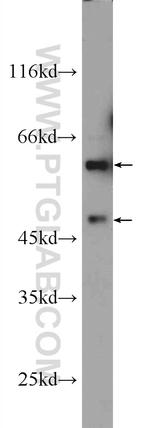 ARCN1 Antibody in Western Blot (WB)