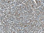 NDUFB5 Antibody in Immunohistochemistry (Paraffin) (IHC (P))