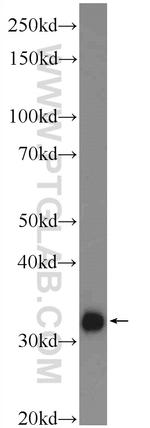 MYOZ3 Antibody in Western Blot (WB)