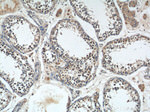 PRPF6 Antibody in Immunohistochemistry (Paraffin) (IHC (P))