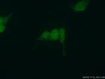 LIN28B Antibody in Immunocytochemistry (ICC/IF)