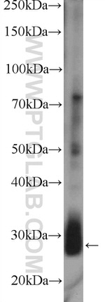 LIN28B Antibody in Western Blot (WB)