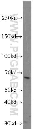 B4GALNT2 Antibody in Western Blot (WB)
