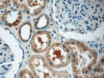 HSN2 Antibody in Immunohistochemistry (Paraffin) (IHC (P))