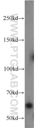 HSN2 Antibody in Western Blot (WB)