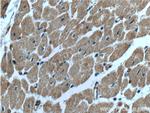 HACE1 Antibody in Immunohistochemistry (Paraffin) (IHC (P))