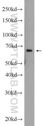 HACE1 Antibody in Western Blot (WB)