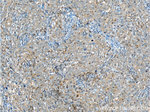 NEK2 Antibody in Immunohistochemistry (Paraffin) (IHC (P))