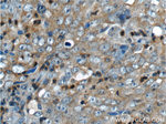 NEK2 Antibody in Immunohistochemistry (Paraffin) (IHC (P))