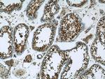 NEK2 Antibody in Immunohistochemistry (Paraffin) (IHC (P))