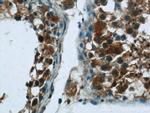 NEK2 Antibody in Immunohistochemistry (Paraffin) (IHC (P))