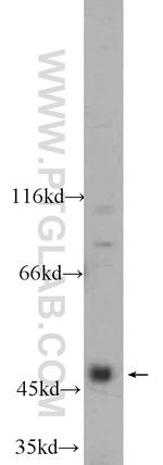 NEK2 Antibody in Western Blot (WB)