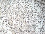 IL-1F6 / IL-36 alpha Antibody in Immunohistochemistry (Paraffin) (IHC (P))