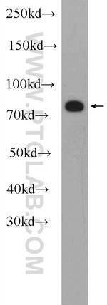 MEFV Antibody in Western Blot (WB)