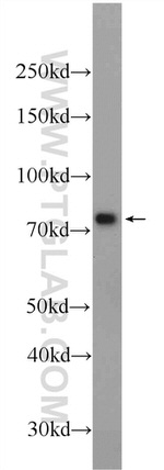 RFTN1 Antibody in Western Blot (WB)