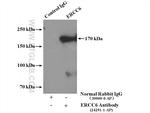 ERCC6/CSB Antibody in Immunoprecipitation (IP)