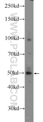 LIPI Antibody in Western Blot (WB)