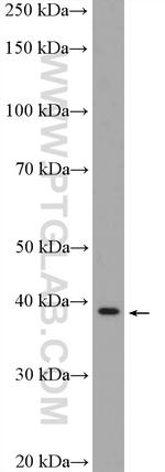 ANKRD16 Antibody in Western Blot (WB)