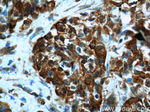 Cadherin-17 Antibody in Immunohistochemistry (Paraffin) (IHC (P))